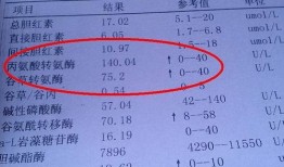 转氨酶高吃小瓜,健康生活新选择