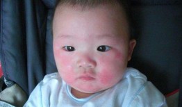 小孩吃角瓜过敏,警惕常见蔬菜背后的健康隐患